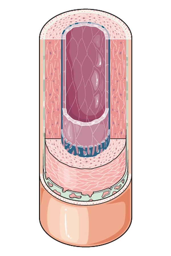 The layers, or tunics, that make up an artery wall.